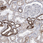 Immunohistochemical staining of human kidney shows strong granular cytoplasmic positivity in cells in distal tubules.
