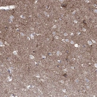 Immunohistochemical staining of human cerebral cortex shows moderate positivity in neuropil.