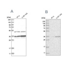 Western blot analysis using Anti-PDHB antibody HPA036745 (A) shows similar pattern to independent antibody HPA036744 (B).