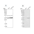 Western blot analysis using Anti-PDHB antibody HPA036745 (A) shows similar pattern to independent antibody HPA036744 (B).
