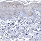 Anti-NIPAL1 Antibody
