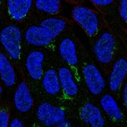 Immunofluorescent staining of human cell line RT4 shows localization to the Golgi apparatus.