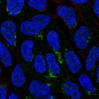Immunofluorescent staining of human cell line RT4 shows localization to the Golgi apparatus.
