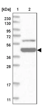 Lane 1: Marker [kDa] 230, 130, 95, 72, 56, 36, 28, 17, 11_br/_Lane 2: Human cell line RT-4