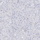 Immunohistochemical staining of human liver shows no positivity as expected.