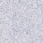 Immunohistochemical staining of human liver shows no positivity as expected.
