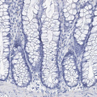 Immunohistochemical staining of human colon shows no positivity in glandular cells as expected.