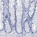 Immunohistochemical staining of human colon shows no positivity in glandular cells as expected.