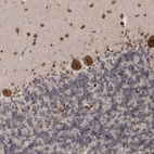 Anti-SOWAHB Antibody