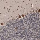 Anti-SOWAHB Antibody