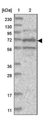 Lane 1: Marker [kDa] 230, 130, 95, 72, 56, 36, 28, 17, 11_br/_Lane 2: Human cell line RT-4