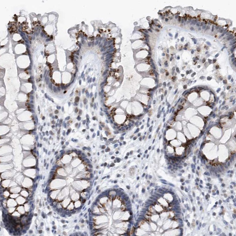 Anti-VWA5B2 Antibody