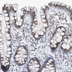 Anti-VWA5B2 Antibody
