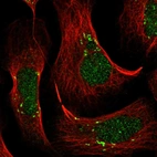 Immunofluorescent staining of human cell line U-2 OS shows localization to nucleus, nucleoli & the Golgi apparatus.