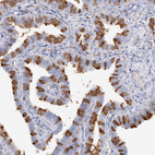 Anti-TAMM41 Antibody