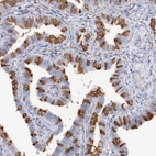 Anti-TAMM41 Antibody