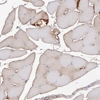 Immunohistochemical staining of human skeletal muscle shows moderate cytoplasmic positivity in myocytes.