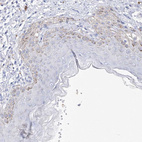 Immunohistochemical staining of human skin shows weak granular cytoplasmic positivity in squamous epithelial cells.