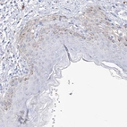 Immunohistochemical staining of human skin shows weak granular cytoplasmic positivity in squamous epithelial cells.