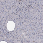 Immunohistochemical staining of human pancreas shows no positivity in exocrine glandular cells as expected.