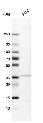 Anti-TAMM41 Antibody