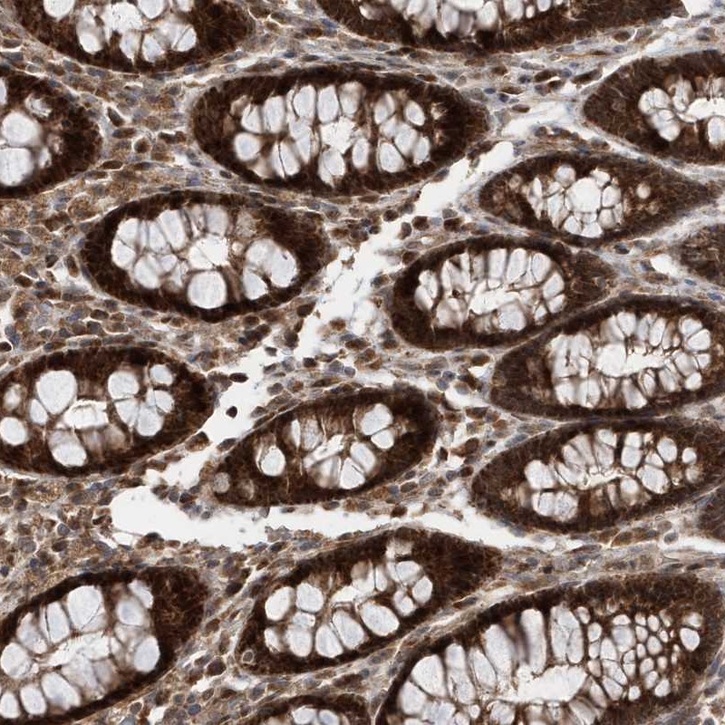 Anti-DALRD3 Antibody