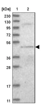 Lane 1: Marker [kDa] 230, 130, 95, 72, 56, 36, 28, 17, 11_br/_Lane 2: Human cell line RT-4