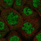 Immunofluorescent staining of human cell line A-431 shows localization to nucleoplasm, nuclear bodies & cytosol.