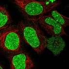 Immunofluorescent staining of human cell line HEK 293 shows localization to nucleus, nuclear bodies & nuclear membrane.