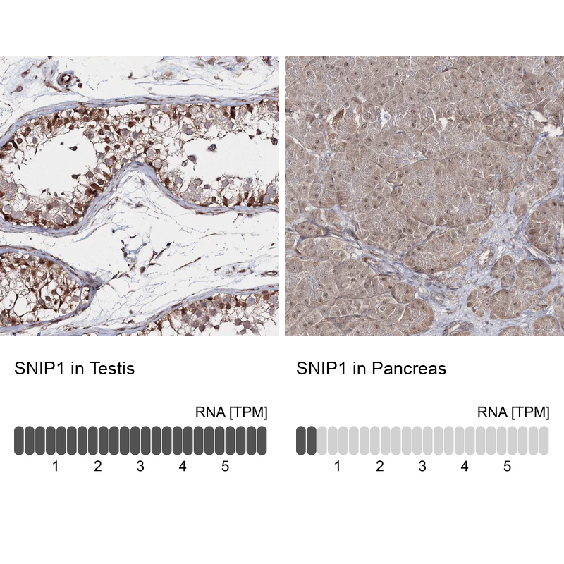 Anti-SNIP1 Antibody