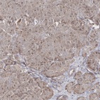 Immunohistochemical staining of human pancreas shows low expression as expected.