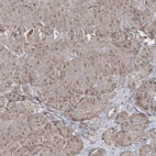 Immunohistochemical staining of human pancreas shows low expression as expected.