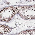 Immunohistochemical staining of human testis shows high expression.
