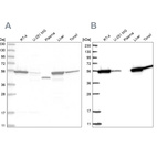 Western blot analysis using Anti-CNDP2 antibody HPA036898 (A) shows similar pattern to independent antibody HPA036899 (B).
