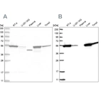 Western blot analysis using Anti-CNDP2 antibody HPA036898 (A) shows similar pattern to independent antibody HPA036899 (B).