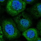 Immunofluorescent staining of human cell line A-431 shows localization to nucleoplasm & cytosol.