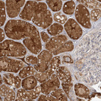 Immunohistochemical staining of human kidney shows strong cytoplasmic positivity in cells in tubules.