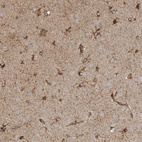 Immunohistochemical staining of human cerebral cortex shows strong cytoplasmic positivity in astrocytes.