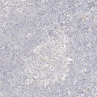 Immunohistochemical staining of human lymph node shows no positivity in germinal center cells as expected.