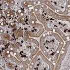 Anti-SLC22A16 Antibody