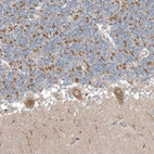 Immunohistochemical staining of human cerebellum shows strong cytoplasmic granular positivity in Purkinje cells.