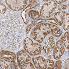 Immunohistochemical staining of human kidney shows strong cytoplasmic granular positivity in cells in tubules.