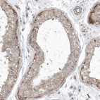 Immunohistochemical staining of human testis shows weak cytoplasmic granular positivity in cells in seminiferous ducts.