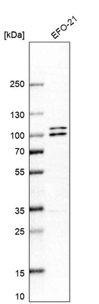 Western blot analysis in human cell line EFO-21.