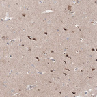 Immunohistochemical staining of human cerebral cortex shows moderate to strong cytoplasmic positivity in neurons.