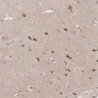 Immunohistochemical staining of human cerebral cortex shows moderate to strong cytoplasmic positivity in neurons.