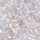 Immunohistochemical staining of human kidney shows weak to moderate cytoplasmic positivity in cells in tubules.