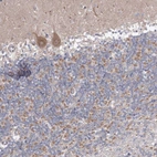 Immunohistochemical staining of human cerebellum shows weak to moderate cytoplasmic positivity in Purkinje cells.