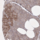 Immunohistochemical staining of human pancreas shows weak to moderate cytoplasmic positivity in exocrine glandular cells.