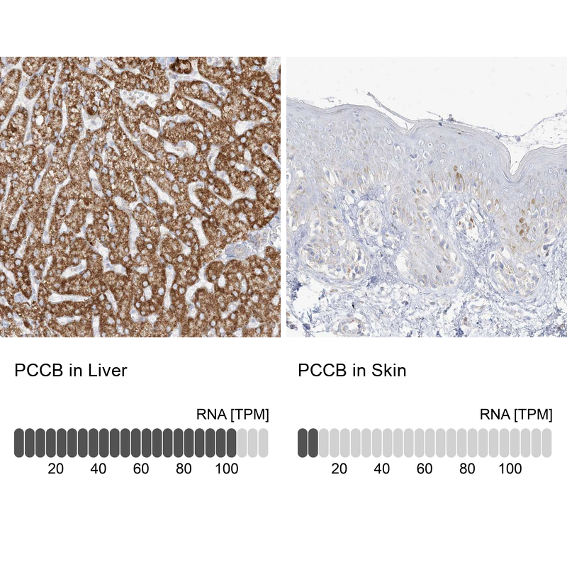 Anti-PCCB Antibody